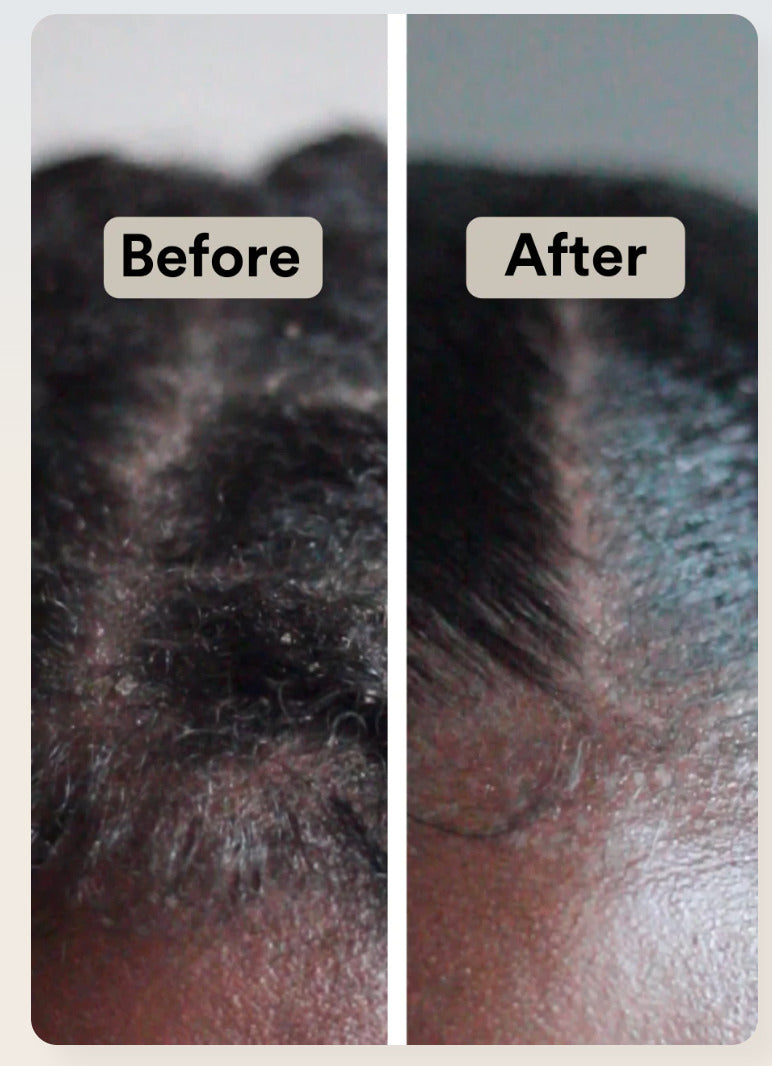 het resultaat van de Natuurlijke shampoo met appelazijn & rijstwater